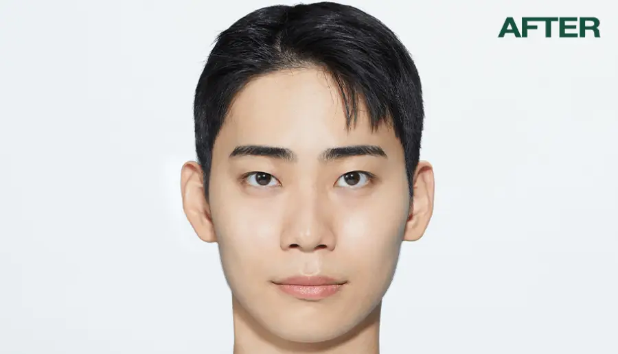 [선케어/반톤업] 닥터지 레드 블레미쉬 포 맨 올인원 톤 로션 50ml 기획 (+젠틀폼 30ml) 상세페이지 18